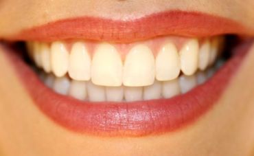 ¿Por qué la ortodoncia ayuda a mejorar la calidad de vida?