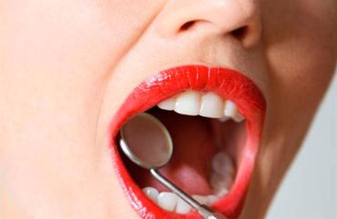 Qué tenés que saber si querés ponerte aparatos