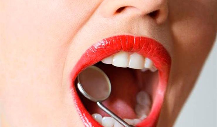 Qué tenés que saber si querés ponerte aparatos