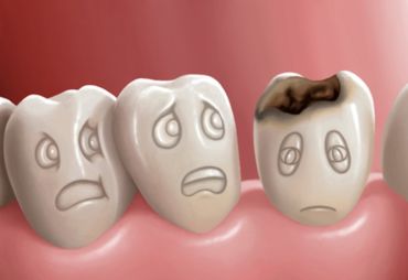 Por esta razón la higiene bucal es fundamental para tu salud