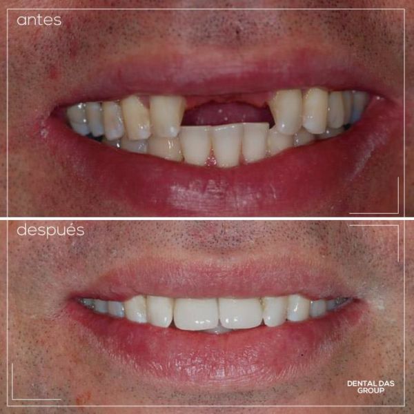 45665157_1099843746845817_1951544817594925056_n