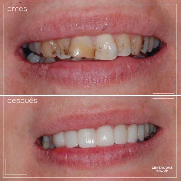 52816977_1171174266379431_7127303579794145280_n